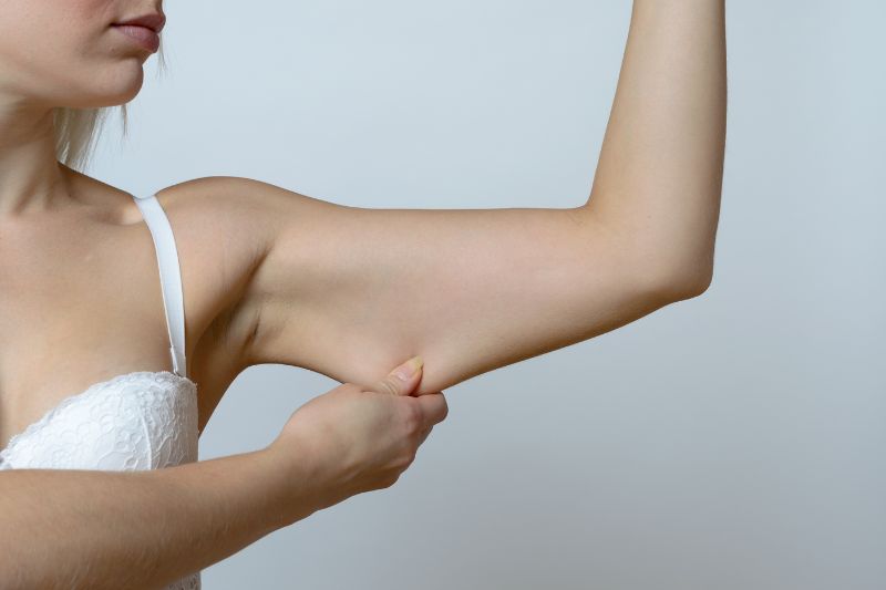 brachioplasty surgery tunbridge wells